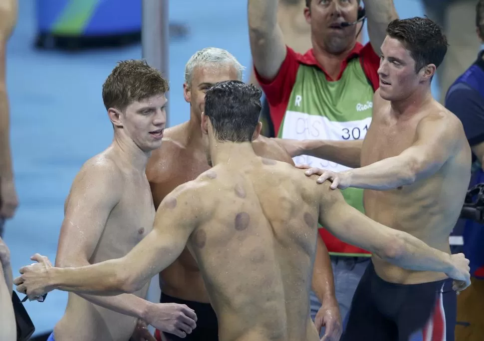 MORETONES. Phelps saluda a sus compañeros de equipo, y en su espalda pueden contarse alrededor de una decena de “chupones”, producto de las ventosas. Reuters