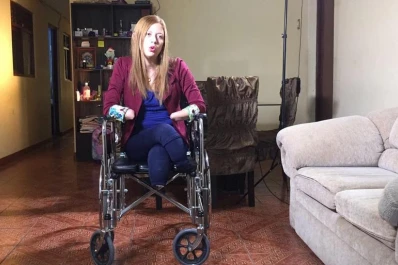 Entró al hospital por cálculos renales y salió sin manos ni pies