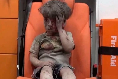 Tras la foto del niño que conmovió el mundo, Rusia apoya una tregua en Alepo