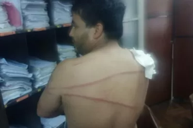 Una fiesta terminó con tiros, heridos y detenidos