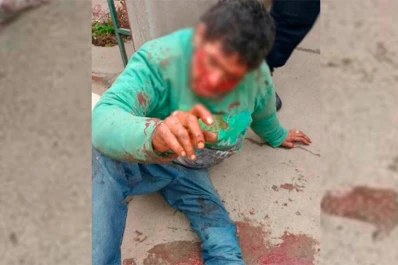 Video: lo desfiguraron a golpes porque habría intentado robar un televisor