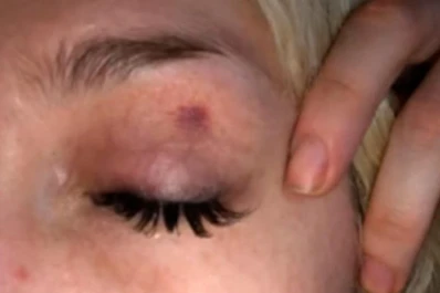 Militta Bora habría sido víctima de violencia de género