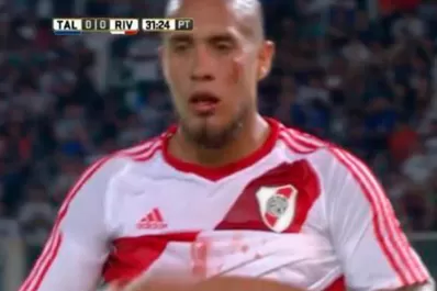 Maidana quedó sangrando luego de un tremendo zapatazo en la cara