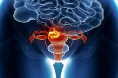 ¿Derrotará al cáncer el virus de la poliomielitis?