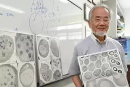 Nobel de Medicina: cinco claves para entender el sistema de reciclaje de las células