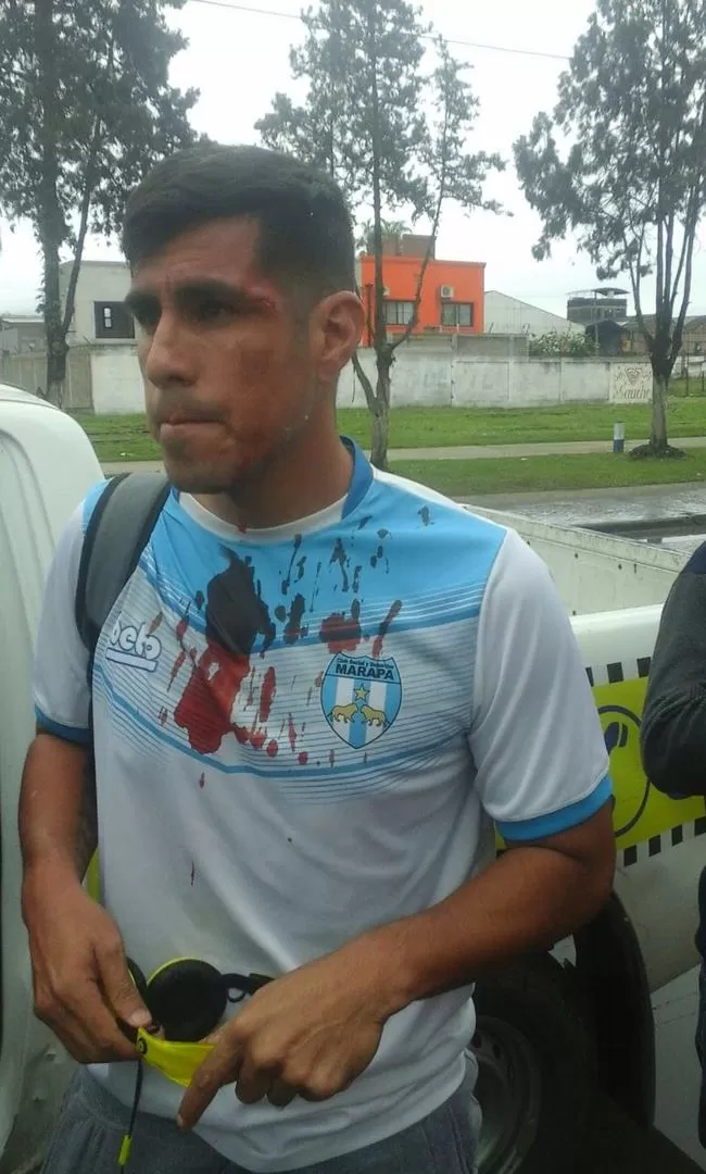 LA IMAGEN HABLA POR SÍ SÓLA. Gómez sufrió un corte en su ojo izquierdo.  