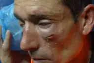 Árbitros iniciarán un paro por la agresión a un juez en el Federal B