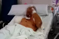 Entró a robar, lo atacó el pitbull del dueño de casa y le amputaron el brazo por las mordidas