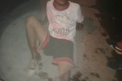 Un joven se fracturó la pierna en un confuso episodio