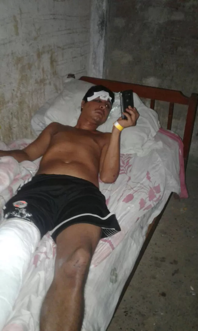 “EL CHUECO”. Julio Vergara, el joven torturado al que un taxista acusó de asaltarlo ayer en Villa 9 de Julio. foto de francisco fernandez