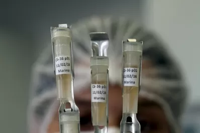 Zika: ya son tres los casos de microcefalia