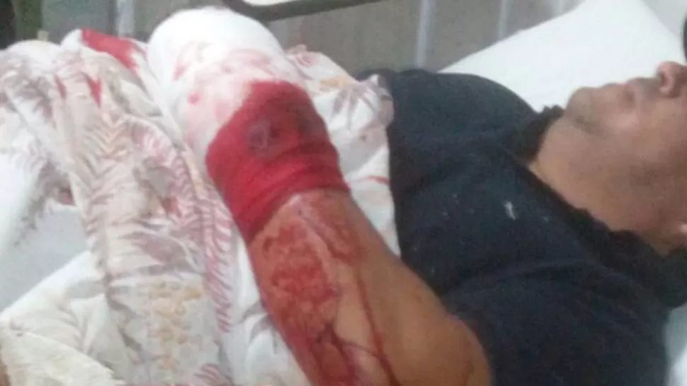 El suboficial Mansilla sufrió heridas graves en mano y antebrazo izquierdos. FOTO GENTILEZA POLICÍA DE TUCUMÁN