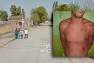 Vecinos atacaron a latigazos a un sobrino de barras de Atlético por un robo