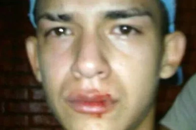 Un padre golpeó a un adolescente por festejar un gol durante un partido de futsal