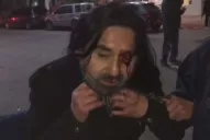 Videos: así fueron heridos algunos manifestantes en Santa Cruz