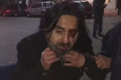 Videos: así fueron heridos algunos manifestantes en Santa Cruz