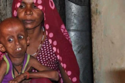 Un joven de 21 años vive atrapado en el cuerpo de un anciano