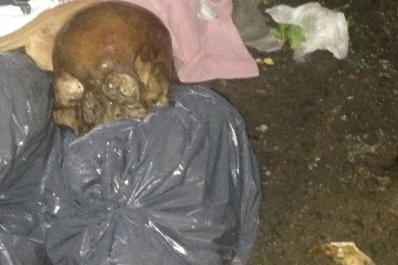 Hallaron un cráneo en una bolsa de basura, en pleno Barrio Sur
