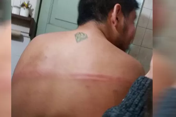 Una joven y su hermano denuncian que fueron agredidos por patovicas en un boliche de Lules