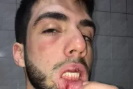 Cruce en un boliche de Yerba Buena: “parecía que la Policía buscaba a Pablo Escobar”