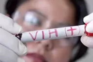 Resistencia a las drogas contra el VIH: detectan problemas en Argentina