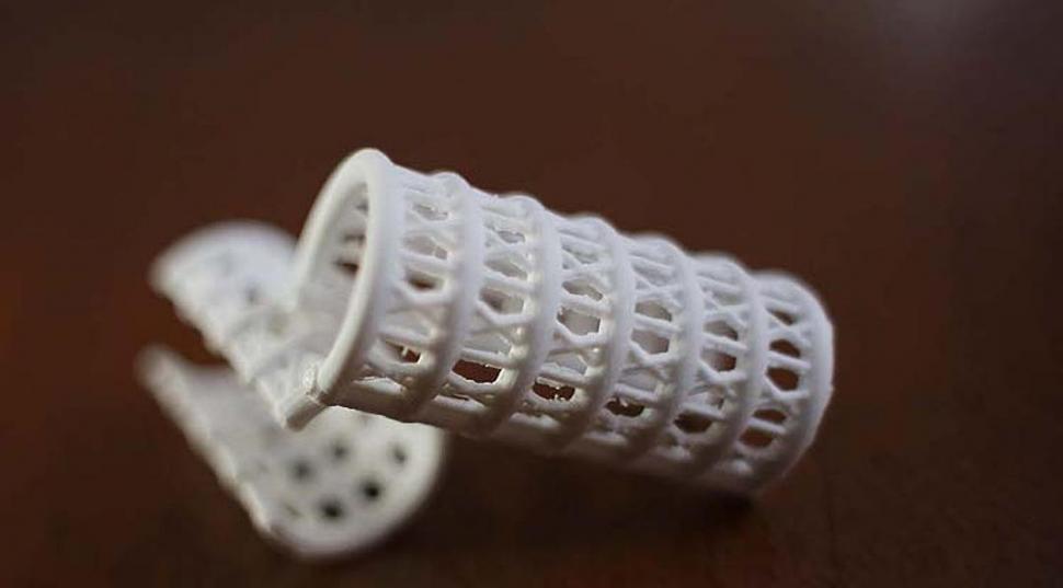 LA PRÓTESIS. Esta es la tráquea que se creó, utilizando un material biodegradable, con una impresora 3D. fotos telam