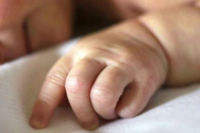 ¡Insólito! Nació un bebé con su gemelo dentro