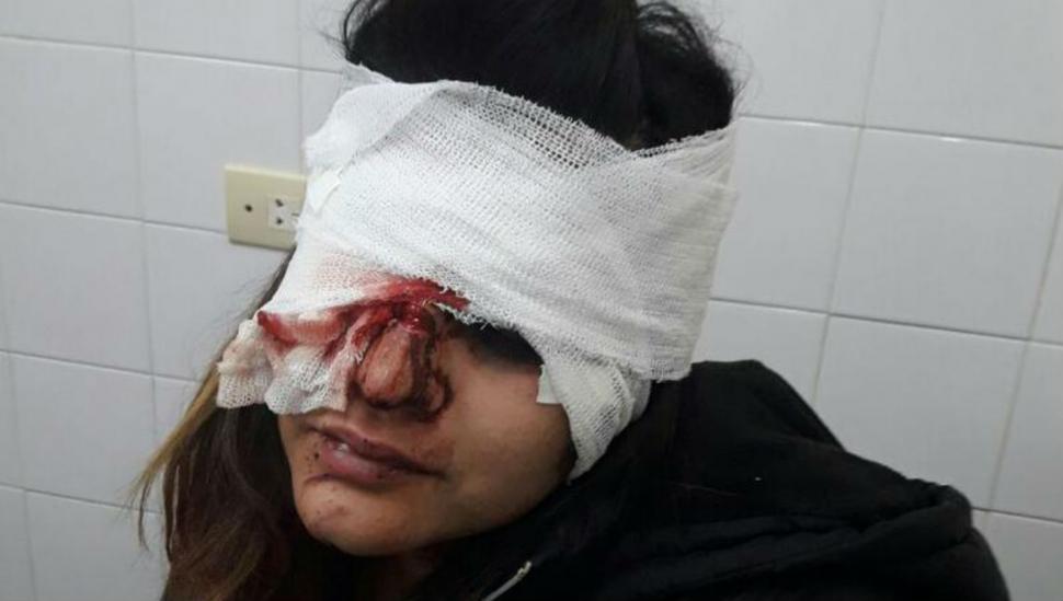 Internan a una joven atacada en un boliche