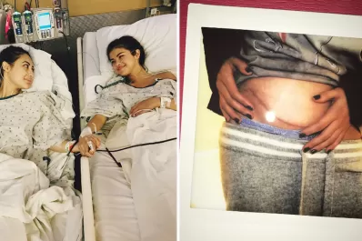 Selena Gómez fue trasplantada y recibió el riñón de una amiga
