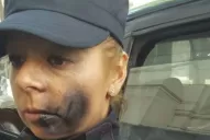 Caso Maldonado: pintaron con aerosol en el cuerpo y en la cara a una policía en la puerta de la morgue porteña