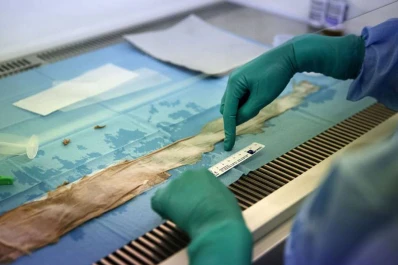 ¡Increíble! Trasplantan casi por completo la piel de un niño mariposa