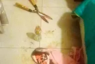 Locura en Córdoba: una mujer le cortó el pene a su amante con una tijera de podar