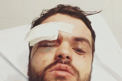 Homofobia: un rugbier terminó internado luego de una brutal golpiza