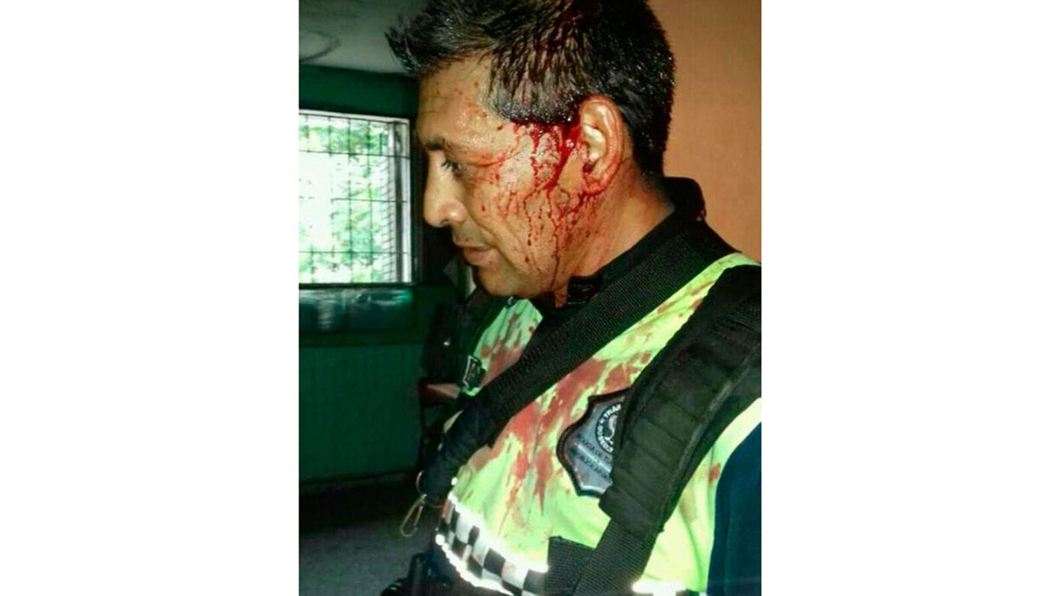 Asaltaron a un taxista, intervino la Policía y se desató una batalla campal en La Bombilla