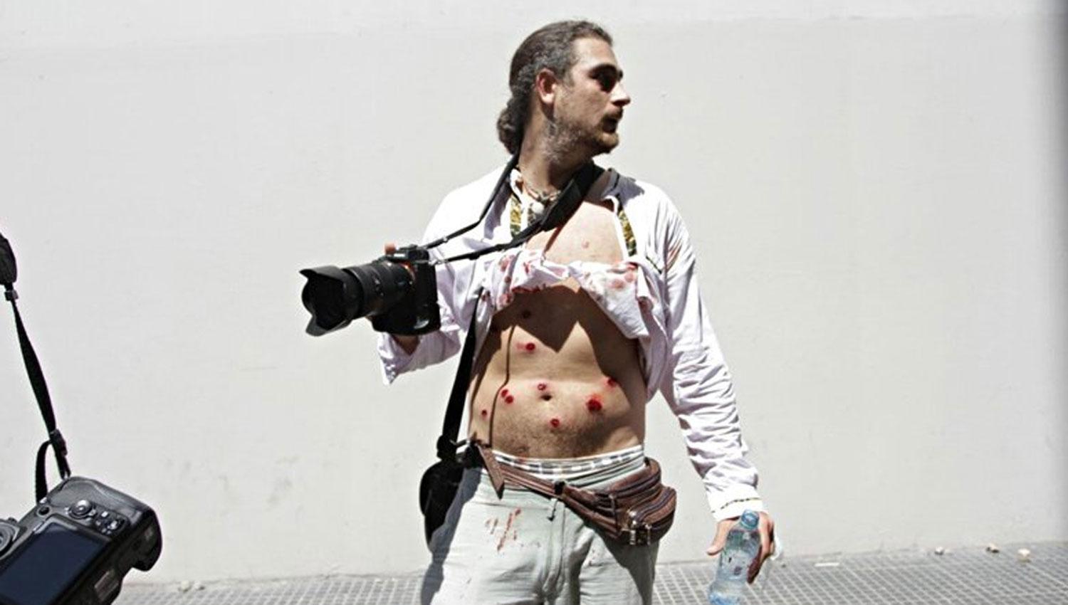BALAS DE GOMA. Piovano fue atacado mientras cubría las manifestaciones en la plaza del Congreso. FOTO TOMADA DE TWITTER.COM/CELS_ARGENTINA