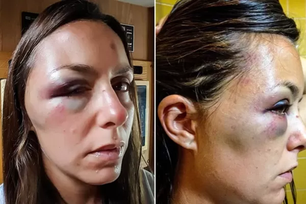 Gracias a Dios no me violaron: la escalofriante historia de la argentina atacada en Ecuador