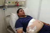 Se recupera el motorista que fue baleado por motochorros