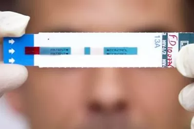 Hoy, testeo rápido de VIH en el parque Avellaneda