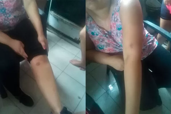 Video: los afectados por los gestores de casas denunciaron que fueron reprimidos por la Policía