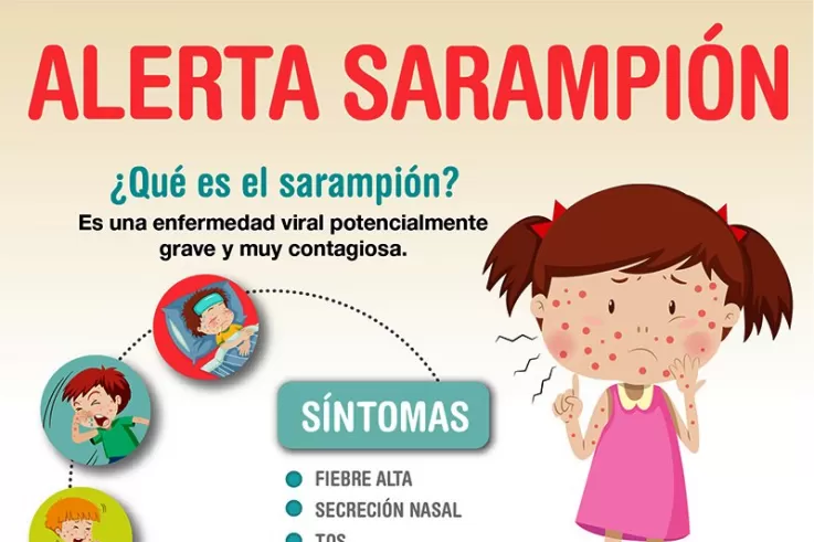 Sarampión: cuáles son los síntomas y qué vacunas son necesarias para prevenirlo