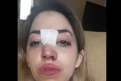 Una tucumana denunció que fue golpeada a la salida de un boliche en Santiago del Estero