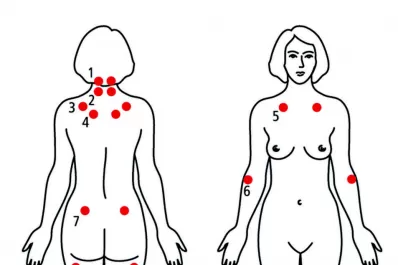 Fibromialgia una guía que ayuda a reconocer la enfermedad