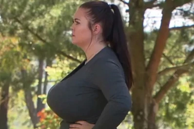 Una mujer sufre una situación insólita: sus senos no dejan de crecer