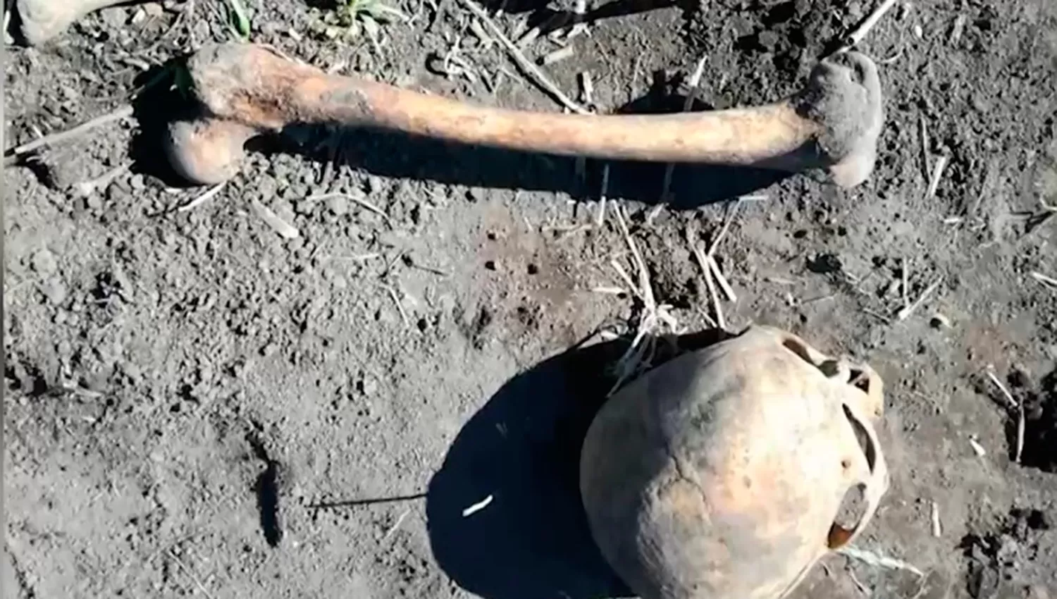 LOS RESTOS. Huesos y un cráneo, eso fue lo que encontró un hombre enterrados en el jardín de su casa. (FOTO DE www.omsk.kp.ru)