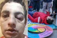 El hombre que se agarró a trompadas con el municipal ya lo había denunciado en 2015