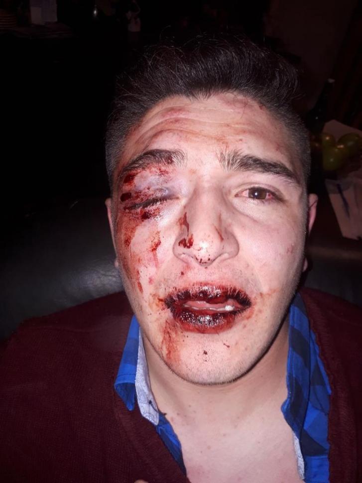Denuncia que patovicas y policías le dieron una golpiza