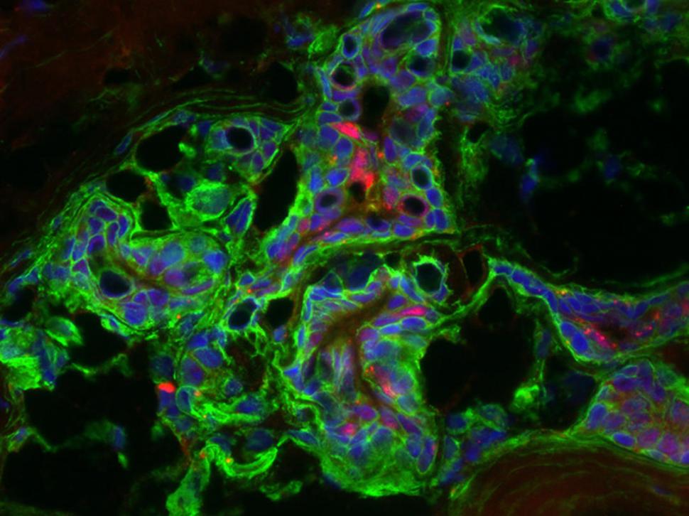 -TEJIDO NORMAL. Los núcleos de las células en  azul, y los receptores de estrógenos (rojo)  y de fibronectina (verde).- 
