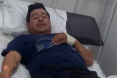 Detienen al conductor que arrolló al cadete que sufrió múltiples fracturas