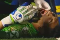 Luego de la polémica por el VAR: Andrada se fracturó la mandíbula y estará dos meses sin jugar