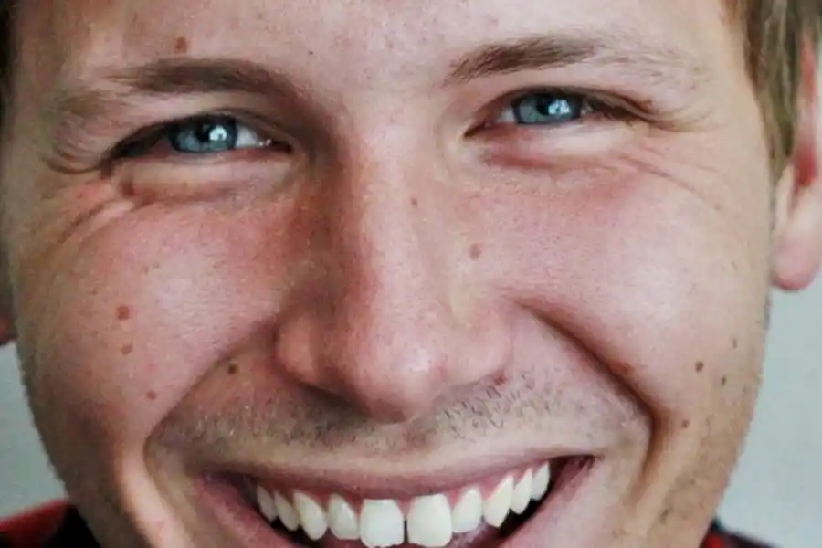 LÍNEAS DE EXPRESIÓN. Desde los 35 lo ideal es comenzar a usar cremas anti-age.